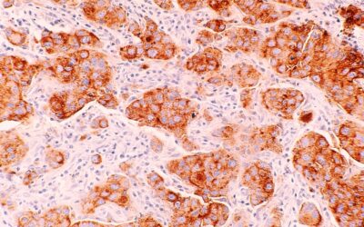 The National Cancer Plan of 2023 